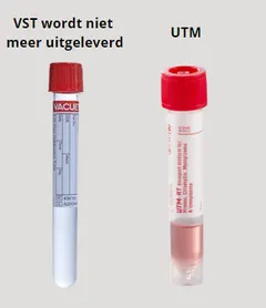 TUBES LABO