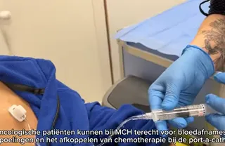Poortkatheterzorg in MCH Leuven en Wezembeek-Oppem