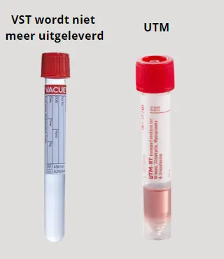 VST wordt vervangen door UTM
